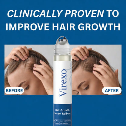 Virexo™ Hair Growth Roll on Serum🌿